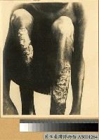 藏品(熱帶皮膚潰瘍寫真)的圖片